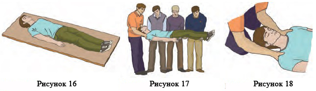Переноска пострадавших при переломе. Переноска пострадавших при переломе. Способы транспортировки пострадавших. Способ сильвестра. Переноска пострадавших при переломе.